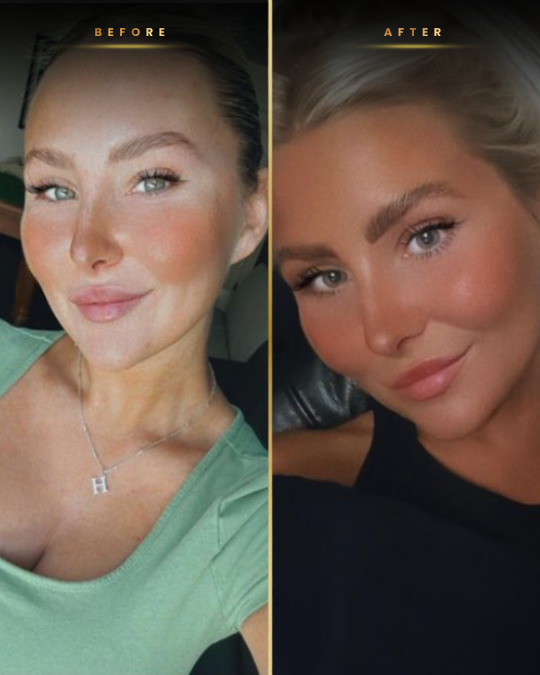 NXT Tanners before and after result 2