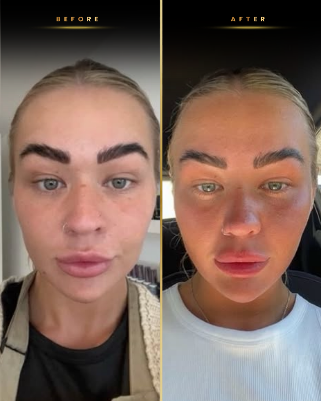 NXT Tanners before and after result 3