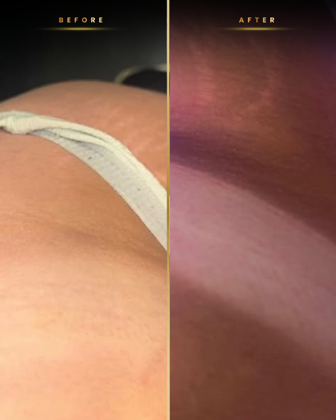 NXT Tanners before and after result 6